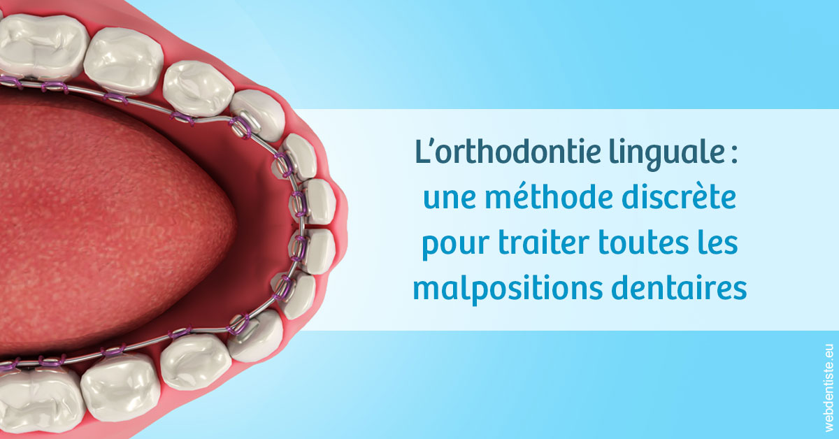 https://dr-amory-christophe.chirurgiens-dentistes.fr/L'orthodontie linguale 1