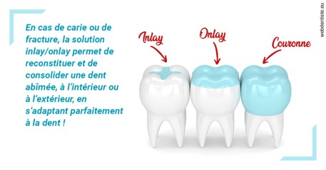 https://dr-amory-christophe.chirurgiens-dentistes.fr/L'INLAY ou l'ONLAY