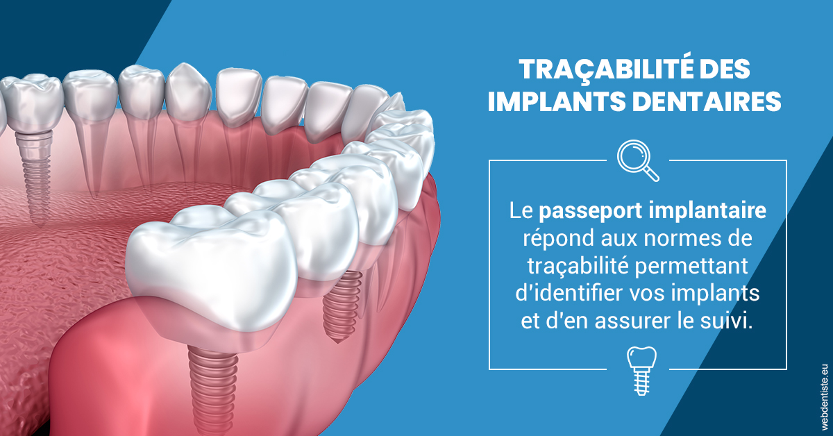 https://dr-amory-christophe.chirurgiens-dentistes.fr/T2 2023 - Traçabilité des implants 1