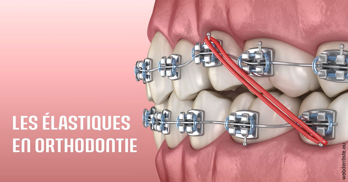 https://dr-amory-christophe.chirurgiens-dentistes.fr/Elastiques orthodontie 2