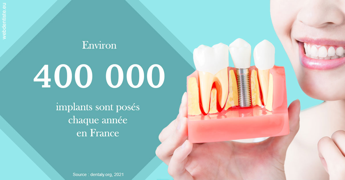 https://dr-amory-christophe.chirurgiens-dentistes.fr/Pose d'implants en France 2