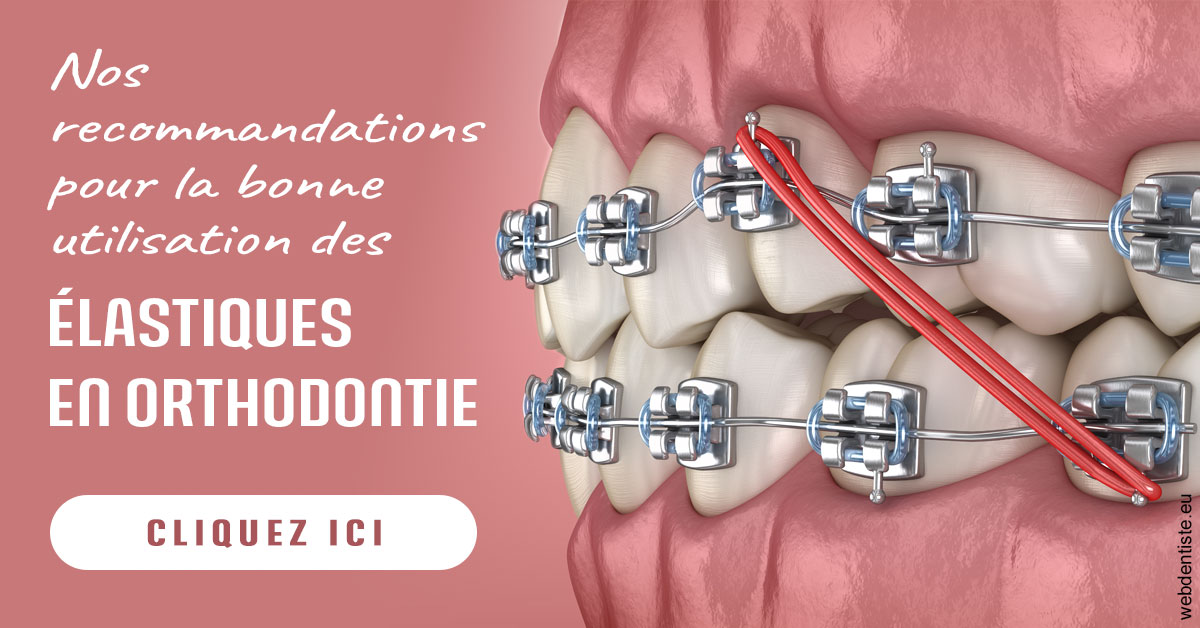 https://dr-amory-christophe.chirurgiens-dentistes.fr/Elastiques orthodontie 2